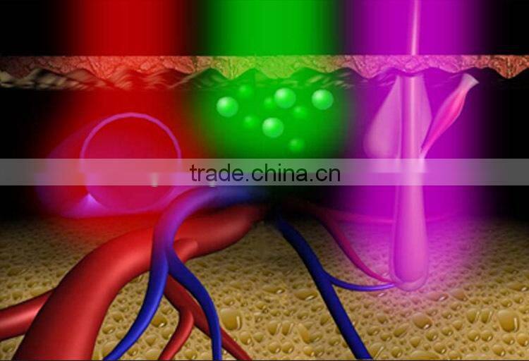 hair removal beauty 808nm soprano laser plastic epilator machine