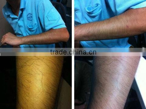 OPT/ SHR Hair Removal and Facial Rejuvenation Machine