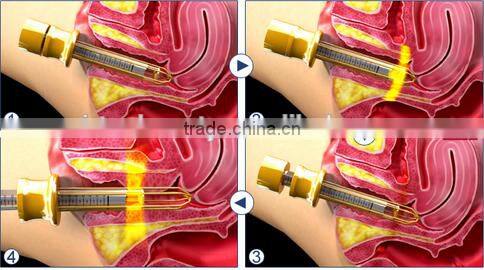 OEM/ODM vaginal tightening for beauty clinic fractional co2 laser rf tube