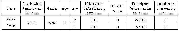 MCT Hard lens For low myopia/MCT lenses/no operation treat myopia,make your eyes normal