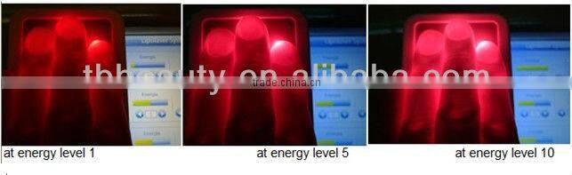 best lipo laser machine for salon