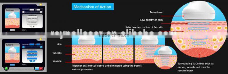 2016 Best Ultrasound Slimming Machine Multifunctional Liposonix
