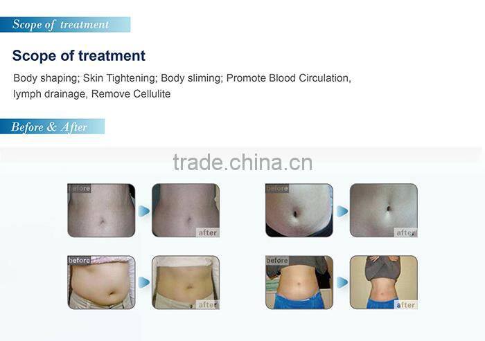 4 in 1 multi-function mode criolipolisys cavitation slimming machine beauty salon equipment