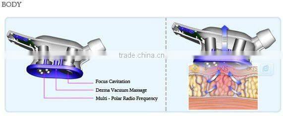 Cavitation Dermo Vacuum Massage Beauty Machine