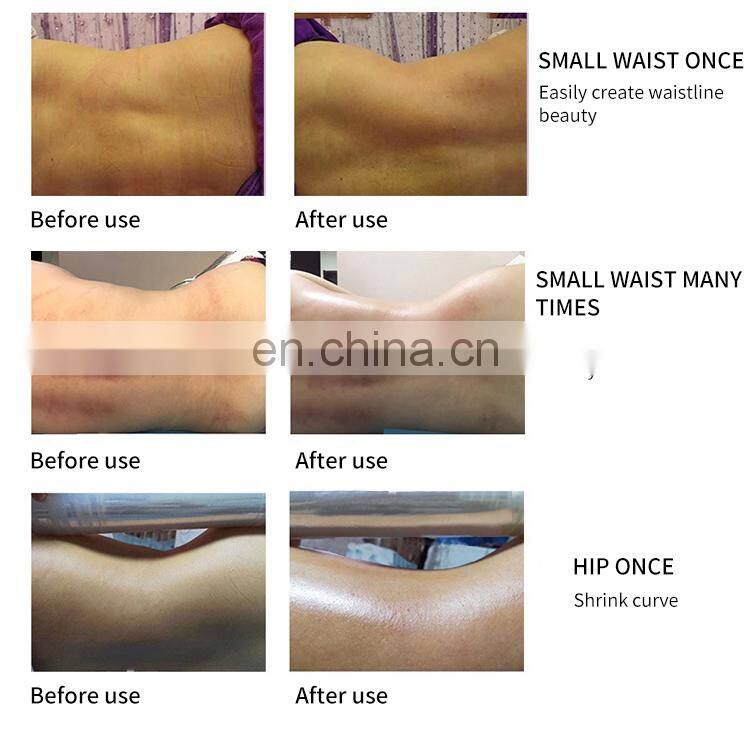 Professional RF+Vacuum Lifting Firming Skin Body Shaping Instrument Cupping Therapy Weight Loss Body Slimming Machine