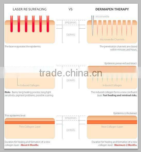 VY-969B Hottest Microneedle electric derma stamp/electric dermaroller metal body