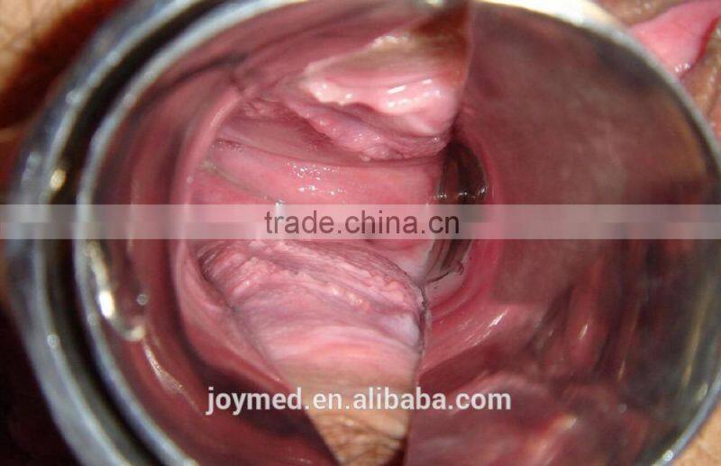 Digital Video Colposcope, Laptop Video Colposcope, Gynecology Video Colposcope