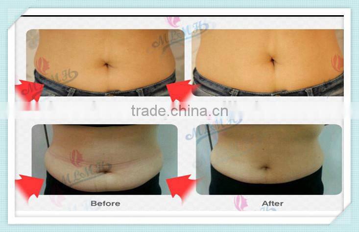 AFY body fat burning slim oil slimming massage oil leg body sliming essence oil