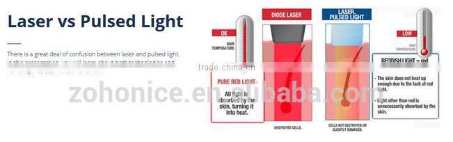 Y9D-Ydel Blue/Gray/purple Colorful 808 nm Diode Laser Hair Removal Beauty Equipment