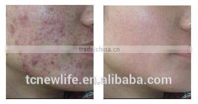 NL-PDT500 BEST ! 2016 Salon Equipment PDT Therapy Machine LED Light Red Blue Yellow for Skin Whitening