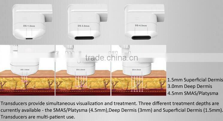 Hot hifu with medical CE