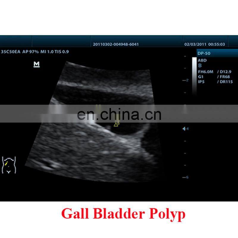 Cheapest Original Mindray DP-50 ultrasound portable ultrasonic diagnosis system/mindary ultrasound