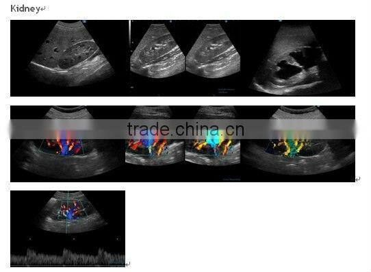 Abdominal/ Vascular/OB/GYN/4D Ultrasound iSpark 480 with CE Approved
