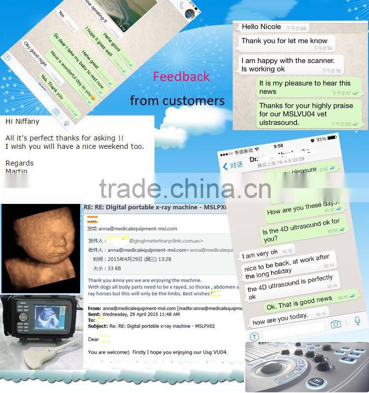 Coupon available! Ipad ultrasound scanner, touch screen scanner 3D color doppler MSLCU22-N