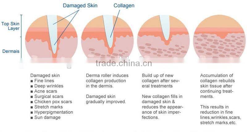 Skin Care 540 Needles derma roller dermaroller, Micro Needles Derma Roller for Home use derma roller dermaroller