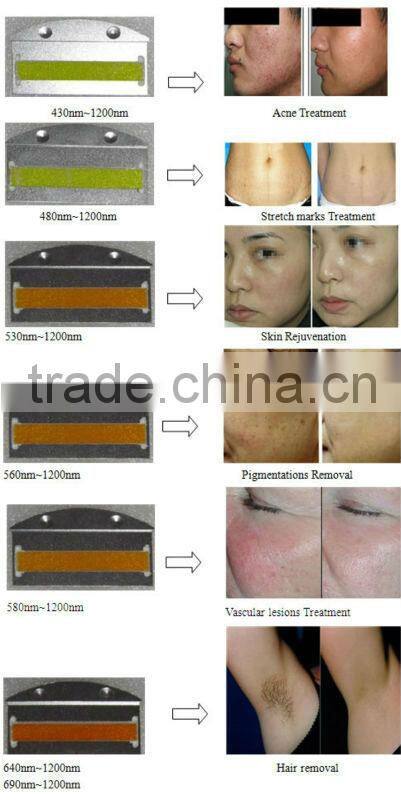 20% discount portable ipl equipment for hair removal with medical ce