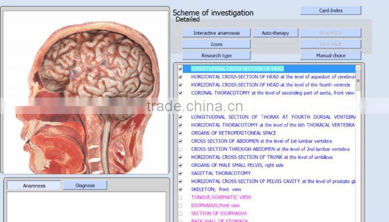 2016 Hot sell 9D NLS quantum magnetic resonance health body analyzer from Phenitech