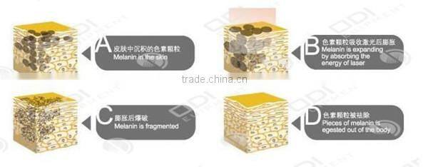 1500W High quality product ND100 CE beauty machine Heiwawa Q Switch ND yag laser tattoo removal machine price