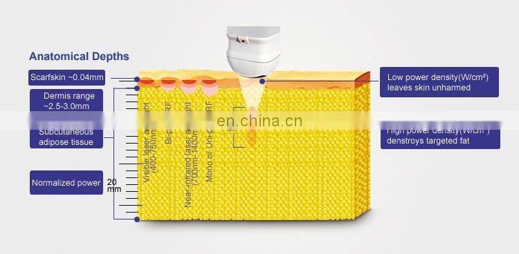 Newest beauty hifu slimming machine price ultrasound hifu equipment for sale