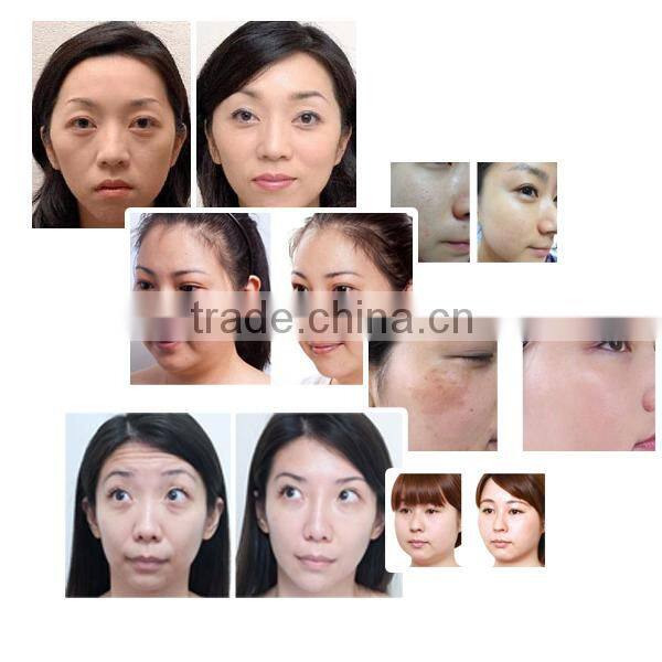 Portable skin lifting mesotherapy gun, skin tightening meso gun, meso beauty gun