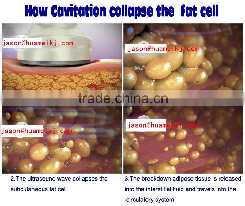 best newest portable rf machine rf slimming machine