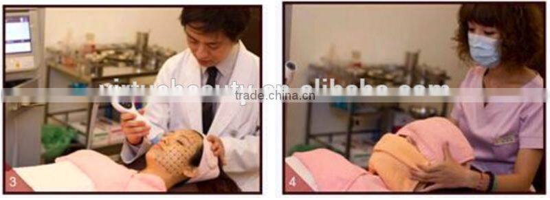 Beauty equipment multifunctional machine hair removal 2015