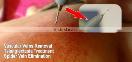 Rbs 30Mhz high frequency spider veins removal vascular therapy machine