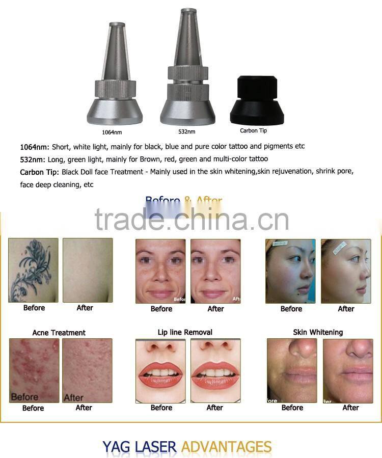 LS900 ODI Manufacturer beauty machine q switched nd yag laser