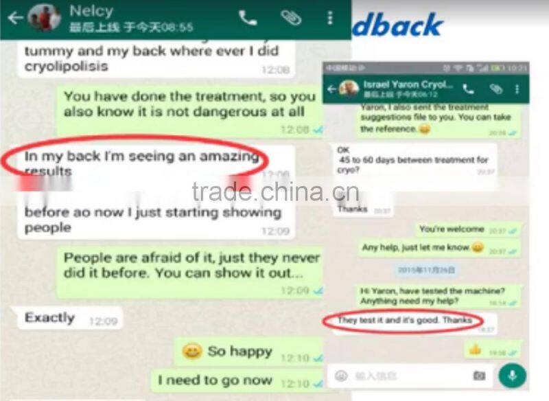 Greece hot sell best cryolipolysis fat freezing machine for sale