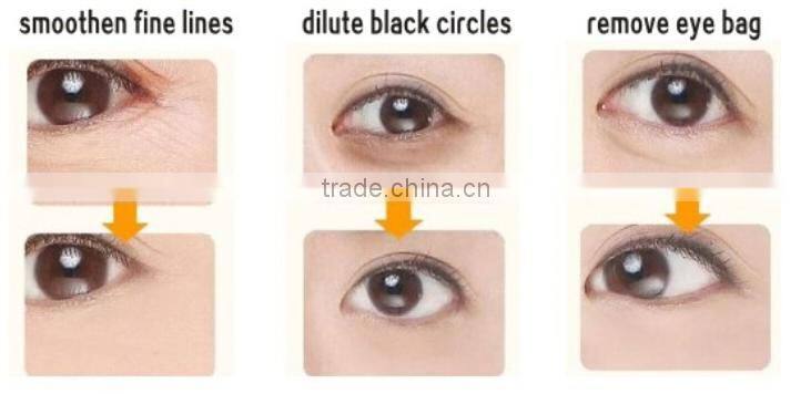 2016 As seen on TV 5 in 1 ultrasonic facial machine face beauty massager