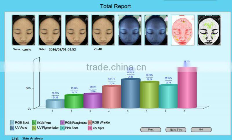 Best sell UV light skin scanner machine detect deep skin moisture content