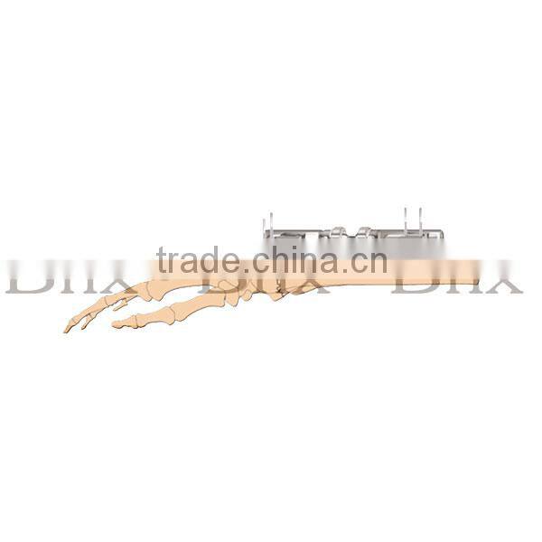 Bone Lengthening Fragment External Fixator