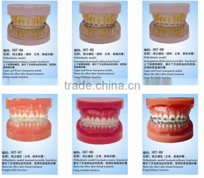 Frasaco Replacement 32 Teeth Model