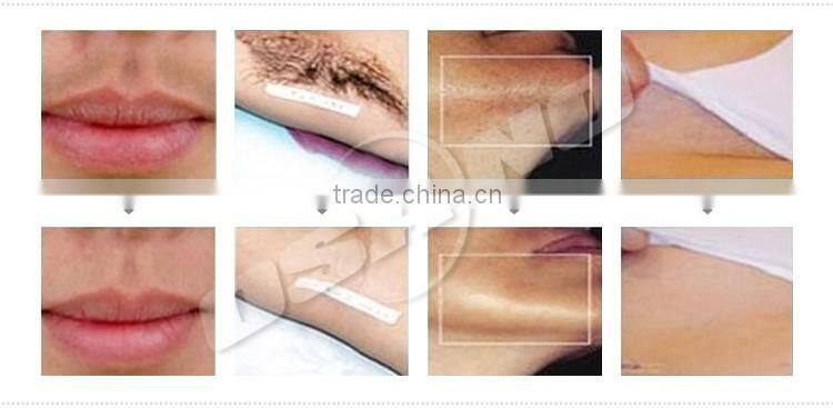 Popular Laser Therapy Laser Hair Remocal Permanent Salon Equipment