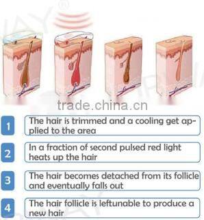 Portable Elight SHR IPL Hair Removal machine /SHR OPT Hair removal