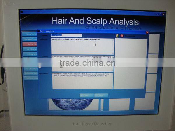 Degital Hair testing hair analysis