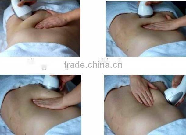 Multipolar rf cavitation facial wrinkle removal machine /skin tightening rf machine