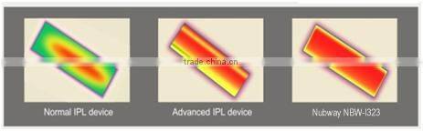 FDA Approved Laser Hair Removal Machine IPL With RF Israel