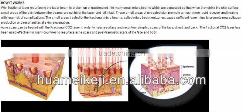fractional CO2 laser beauty machine 8.14 truecolor touch LCD