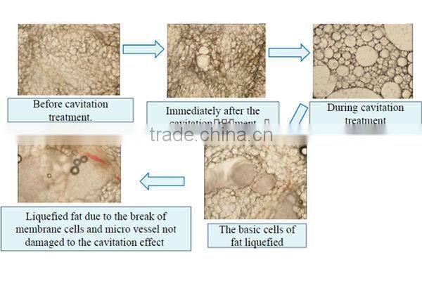 New Innovative 4 in 1 Beauty Machine