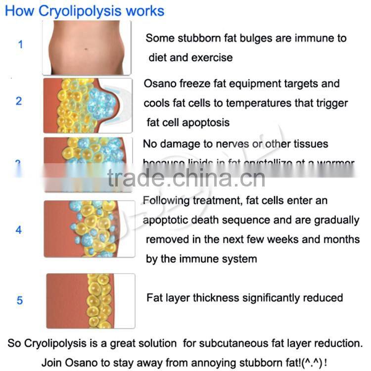 Customer Good Feedback Beauty Machine Vacuum Kryolipolyse