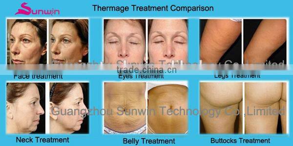 Newest Mini rf facelift machine SW-202B