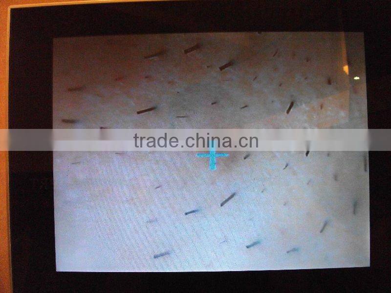 beauty equipment machine