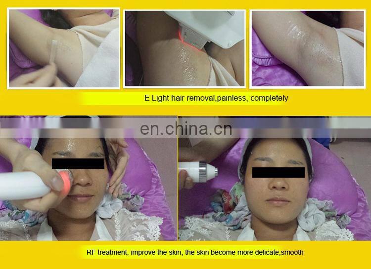 ipl rf  multifunctional machine