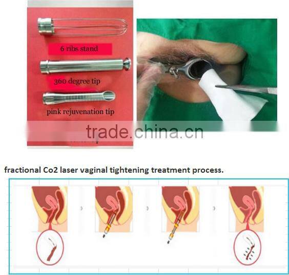 CO2 fractional laser medical spa equipment
