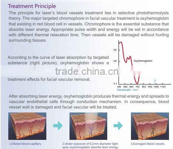 Portable 980nm laser non-invasive veins vascular removal beauty equipment with good effect