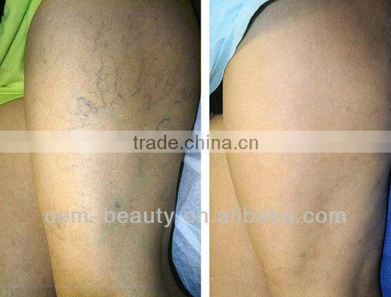laser depilator long pulse laser permanent hair removal beauty equipment