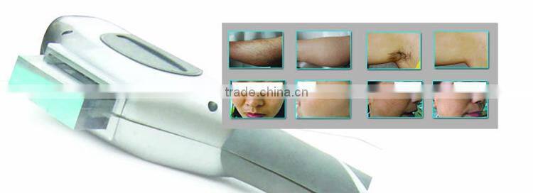 2016 new shape!!! ipl laser permanent facial hair removal for women for beauty salon
