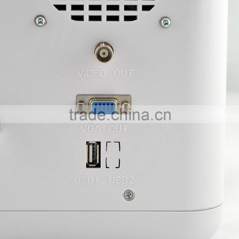 2016 Large Screen LED Clear Image Full Digital Portable ultrasounic Scanner Machine System with 2 probe connector