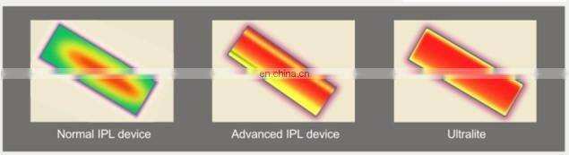 GSD Star product!!! Ipl and professional hair removal beauty machine with CE